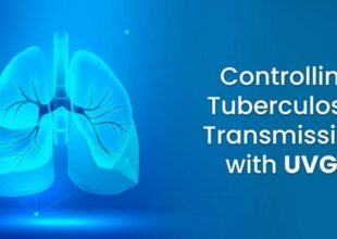 Controlling Tuberculosis Transmission with UVGI